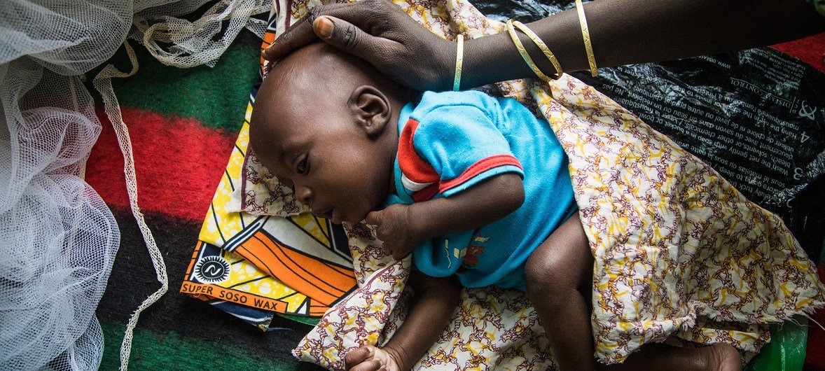 1.9 million children under five could die from severe malnutrition.